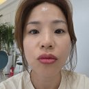 2020-472 | 대전 아이라인 베스티 원장님께 받은 역대급 입술 중화 립틴트 시술 과정