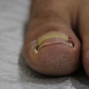 예지인 의료기기 이미지