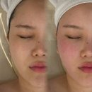 Beautyon(뷰티온) | 옥정피부관리 옥정뷰티온 피부&헤드스파 :: 윤곽관리 전, 후 후기