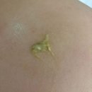 토앤레더스페이스 | 영등포 에스테틱, 스페이스뷰티 영등포시장점에서 AI바디스캐너로 체형교정 후기