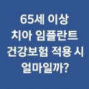 &#34;65세 이상 치아 임플란트, 건강보험 적용하면 얼마일까? 실비·병원·계산기 총정리&#34;