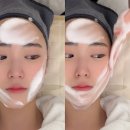 지니메디칼 | 부산 용호동 피부관리 모공청소 1회만에 깐달걀 피부 된 후기