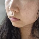 올림피움채움올피채의원 이미지