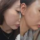 세예의원 | 강남 세예의원 인모드후기✨️내돈내산이여