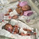 동산의료기상사 | 대구가톨릭대학교병원 출산 35주2일 쌍둥이 제왕절개 니큐입원