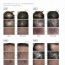 에이치엘HAIR 네이버블로그