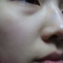 [제이더블유메디] 더마지앤피 MGF 페이스 필 마스크팩 : 주름 개선 마스크팩 추천