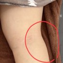 오늘은Nail 내일은피부