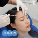 케이스타의원 | 광주이마필러 성형외과 후기와 용량보다 개인에 맞는 접근이 중요한 이유
