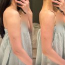 포텐핏 | 동탄신부관리 체험, 승모근과 팔뚝살까지 선에스테스파 동탐역점에서 관리받고 온 후기!