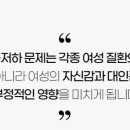미즈존