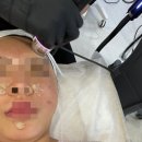 씨제이올리브영(주) 서면가야대로점 | 서면피부관리 ESV/트라이엄 시술 받고 온 후기 : 뷰티 119