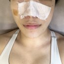 에스제이 | 평택 피부관리 sj에스제이 파메스테틱 피부연구소 수분 충전 후기