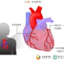 심장질환(특정Ⅰ)진단비Ⅲ(초경증간편가입)와 심장질환(특정Ⅱ)진단비Ⅲ(초경증간편가입)의 분류표 비교 이미지