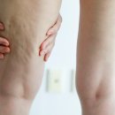 잠실비엘에스의원 이미지