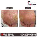 레푸스 망우점 이미지