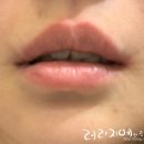 허정민치과교정과치과의원 네이버블로그