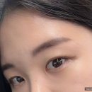 넬래쉬