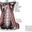 드물지만 neck pain 통찰하는데 중요한 질환 longus colli tendinitis 이미지