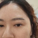 피부아지트(뉴페이스) 이미지