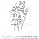 수부 건의 문제들2(hand tendon problems2)-건의 파열 이미지