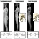 Sagittal balance of spine! 이미지