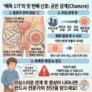 나득영심혈내과의원 | 남자 매독 증상 병원에서 실제로 많이 보는 초기 증상