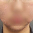 블루밍의원 이미지