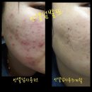 사랑인셀덤 네이버블로그