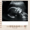 심HC | 정밀초음파 시기와 얼굴 임신 20주,21주,22주,23주