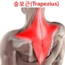 담 걸리는 이유, 근막통증 증후군 (뒷목 뻐근, 어깨뭉침, 가슴담 목담, 연관통) 이미지