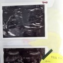 임당13-37 농로 | 부천서울여성병원 정밀초음파 임당검사 입체초음파 내과 검사비용 21주~31주