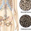 골다공증 예방에 좋은 음식 10가지 이미지