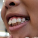진주쥬니어치과의원 네이버블로그