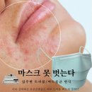 샘이나는피부 이미지