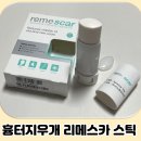 열린대학약국 | “흉안지게하는법? 리메스카 창상피복제 흉터치료제 추천” 공구가로 구매