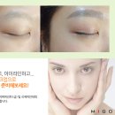미고뷰티센터