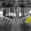송탄바른치과의원 이미지
