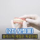 아치날 | 풀아치 임플란트 후기.. 젊은 날의 나는 내가 치아를 모두 잃을 줄 몰랐다..
