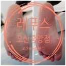 레푸스오산 이미지
