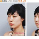 유(有) 이미지
