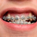 미소를만드는치과교정과치과의원 | 부산동래치과, 치아 교정에 대한 궁금증을 풀어드리겠습니다!
