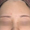 노즈랩의원 이미지