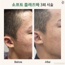 더스무스스킨케어&왁싱 네이버블로그