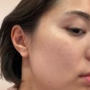 우유빛의원 | 내돈내산 [강남 리쥬란힐러/스킨부스터] 신논현역 우유빛의원에서 리쥬란 &amp; 스킨보톡스 후기