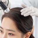 더스칼렛두피탈모센터
