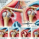무브 유 | [고잔동피티 고잔동pt]안산 고잔동 재활운동 어깨 손상 방카르트 유x철님 회원님 무브릿지pt 찐 수기 후기