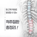 거제 신경외과: 이유 없는 허리 통증? 원인은 약해진 '등 근육'에 있습니다!