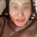 나의 비염 탈출 일기 : 김제 인정한의원 비염 한약 내돈내산