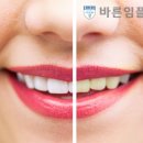 가이드치과기공소 이미지